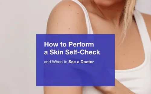 How to Perform a Skin Self-Check