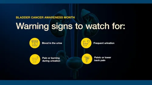 Bladder cancer signs: blood in urine, frequent urination, pain, pelvic or lower back pain.
