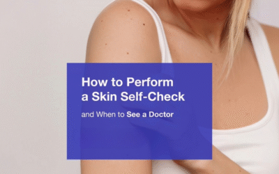 How to Perform a Skin Self-Check (And When to See a Doctor)