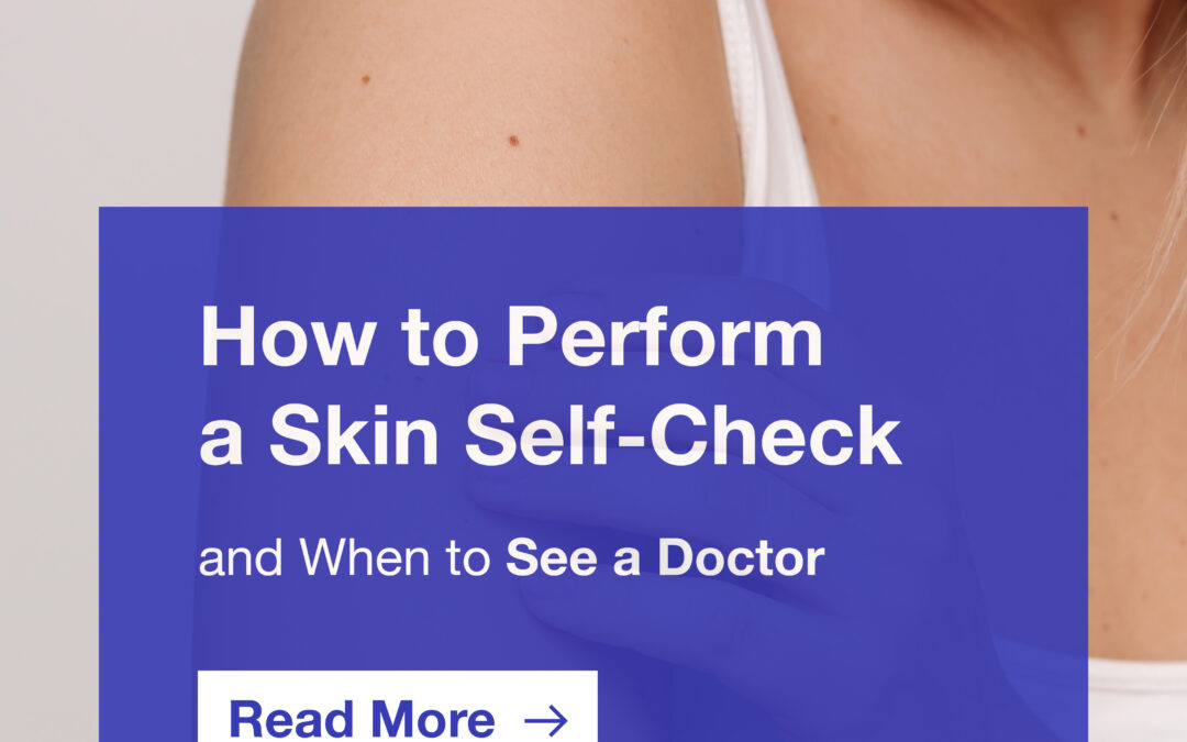 skin self check