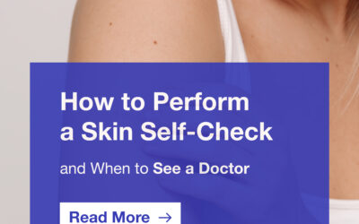 How to Perform a Skin Self-Check (And When to See a Doctor)