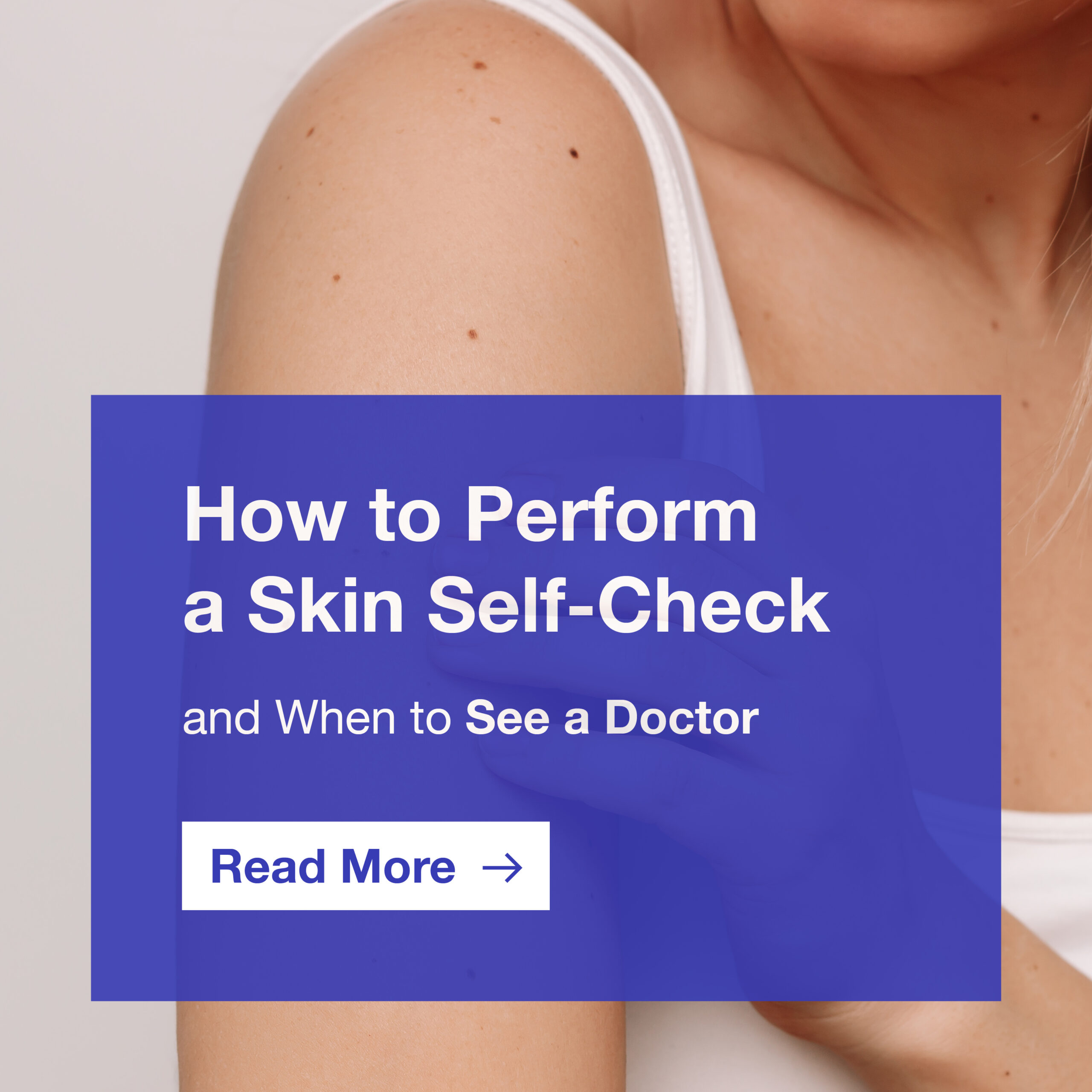 skin self check